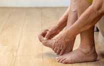 Ce Que L’état de Vos Pieds Peut Dire Sur Votre Santé Générale