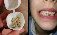Gardez les Dents de Lait : Le Trésor Inestimable pour la Santé de Votre Enfant