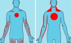 Crise cardiaque ou crise de panique : apprenons à faire la distinction entre les symptômes