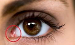 Voici ce que signifie ce petit angle rose au coin de votre œil