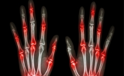3 exercices de 10 secondes que toute personne souffrant d’arthrite doit effectuer chaque matin !