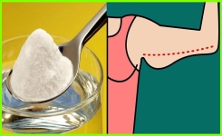 3 manières d’utiliser le bicarbonate de soude pour éliminer à la fois la graisse du bras, de la cuisse, des hanches, du ventre et du dos