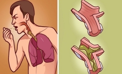 Quand vos poumons se noient dans le mucus, Voici le meilleur traitement