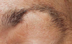 Traitement naturel contre l'alopécie des sourcils et des cils