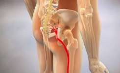 4 étirements du muscle piriforme pour se débarrasser de la sciatique, des douleurs de la hanche et du bas du dos !