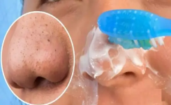 Comment enlever les points noirs sur le nez et le visage