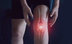Arthrose du genou : 5 exercices essentiels pour soulager la douleur 