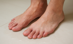 Transpiration excessive du pied : comment lutter efficacement ?
