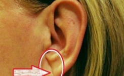 Si vous avez une ligne ou un pli dans les lobes de vos oreilles, lisez attentivement cet article 