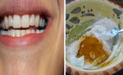 Elle met ces deux ingrédients sur ses dents et le résultat est juste incroyable !